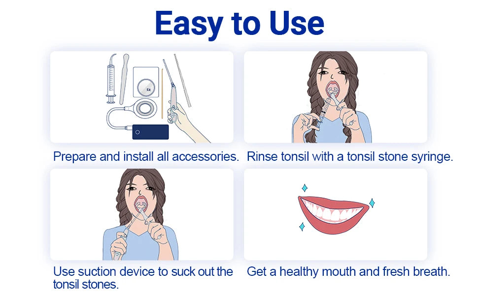 OralHealthHeroes™ Electronic Tonsil Stone Removal Vacuum